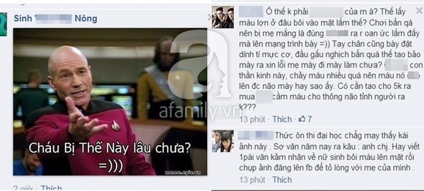 Thiếu nữ Hải Dương đăng ảnh mặt đầy máu trên Facebook để tỏ lòng hiếu thảo với mẹ 2
