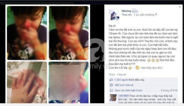 Thiếu nữ Hải Dương đăng ảnh mặt đầy máu trên Facebook để tỏ lòng hiếu thảo với mẹ 1