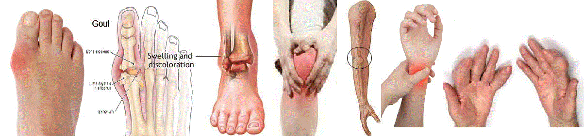 Trị gout hiệu quả với trà nở ngày đất 2(1)