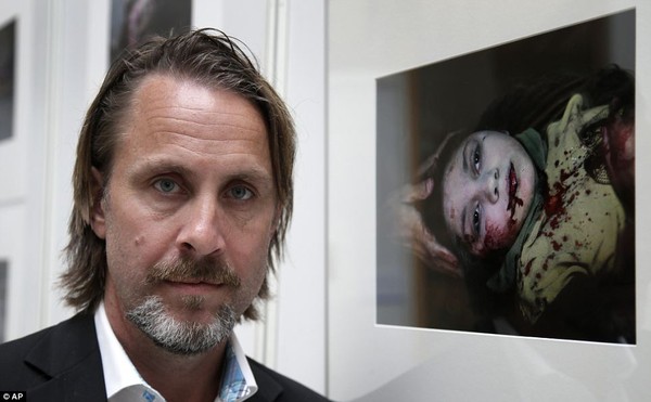 Ánh mắt ám ảnh của bé gái 11 tuổi bị thương trong cuộc nội chiến Syria 1